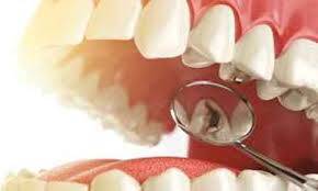 What to do about failing teeth? – PH-39