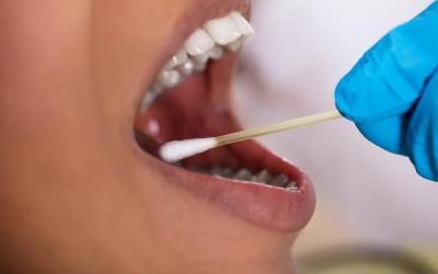 Gum Disease: A Risk Factor for Sever Covid-19 Illness